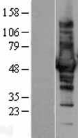 CORO1B Human Over-expression Lysates NM_020441