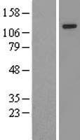 Zinc finger MIZ domain containing protein 1 (ZMIZ1) Human Over-expression Lysates NM_020338