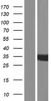 KIAA1191 Human Over-expression Lysates NM_001079684