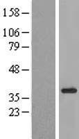 KIAA1191 Human Over-expression Lysates NM_001079685
