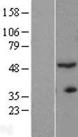 ls057180 actr3b human over expression lysates nm 020445 wb testing 1