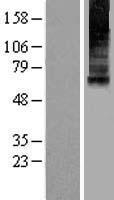 Mucolipin 1 (MCOLN1) Human Over-expression Lysates NM_020533