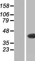 THAP11 Human Over-expression Lysates NM_020457