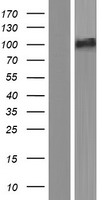 SMEK2 (PPP4R3B) Human Over-expression Lysates NM_001122964