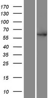 SMEK2 (PPP4R3B) Human Over-expression Lysates NM_020463