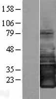 SMAGP Human Over-expression Lysates NM_001031628