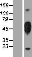 KIR2DL5A Human Over-expression Lysates NM_020535