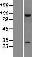 CSRP2BP (KAT14) Human Over-expression Lysates NM_020536