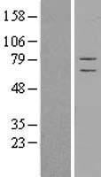 CSRP2BP (KAT14) Human Over-expression Lysates NM_177926