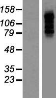 PBXIP1 Human Over-expression Lysates NM_020524