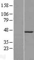 CBX8 Human Over-expression Lysates NM_020649