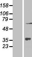 ZNF286 (ZNF286A) Human Over-expression Lysates NM_020652