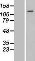 SENP7 Human Over-expression Lysates NM_020654