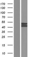 MRS2 Human Over-expression Lysates NM_020662