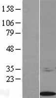 S100 calcium binding protein A14 (S100A14) Human Over-expression Lysates NM_020672