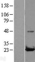 RAB22A Human Over-expression Lysates NM_020673