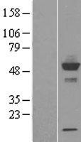 CYP20A1 Human Over-expression Lysates NM_177538