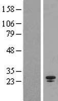 SPC25 Human Over-expression Lysates NM_020675
