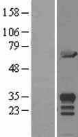 MIF4GD Human Over-expression Lysates NM_020679