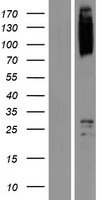 SCYL1 Human Over-expression Lysates NM_001048218