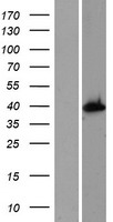 Cyt 19 (AS3MT) Human Over-expression Lysates NM_020682