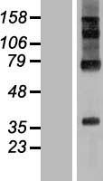 RHBDD2 Human Over-expression Lysates NM_001040456