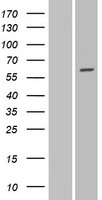 ls057452 galntl1 galnt16 human over expression lysates nm 020692 wb testing 1