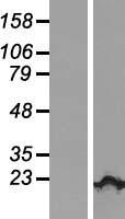 KIAA1143 Human Over-expression Lysates NM_020696