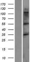 TMCC3 Human Over-expression Lysates NM_020698