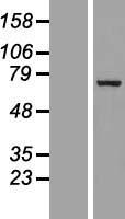 p66 beta (GATAD2B) Human Over-expression Lysates NM_020699