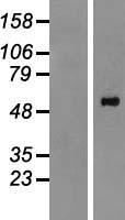 PPM1H Human Over-expression Lysates NM_020700
