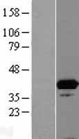 ISY1 Human Over-expression Lysates NM_020701