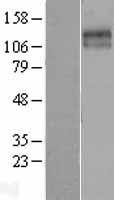 KCC2 (SLC12A5) Human Over-expression Lysates NM_020708