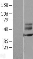 ERMN Human Over-expression Lysates NM_020711