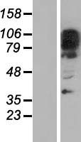 ZNF512B Human Over-expression Lysates NM_020713