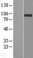 ls057488 fam62b esyt2 human over expression lysates nm 020728 wb testing 1