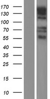 GPR158 Human Over-expression Lysates NM_020752