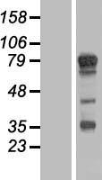 TBC1D14 Human Over-expression Lysates NM_001113361
