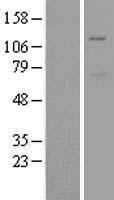 MIB1 Human Over-expression Lysates NM_020774