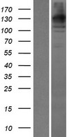 WDR35 Human Over-expression Lysates NM_020779