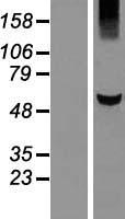 KLHDC5 (KLHL42) Human Over-expression Lysates NM_020782