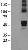 AADACL1 (NCEH1) Human Over-expression Lysates NM_020792