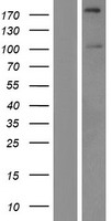 SIPA1L2 Human Over-expression Lysates NM_020808