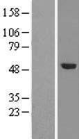 TRMT5 Human Over-expression Lysates NM_020810