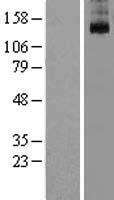 KCNT1 Human Over-expression Lysates NM_020822