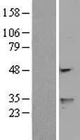 FENS1 (WDFY1) Human Over-expression Lysates NM_020830