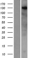 ZNF687 Human Over-expression Lysates NM_020832