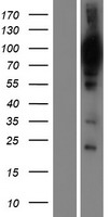 WDR48 Human Over-expression Lysates NM_020839