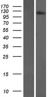FNIP2 Human Over-expression Lysates NM_020840