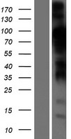 STIM2 Human Over-expression Lysates NM_020860